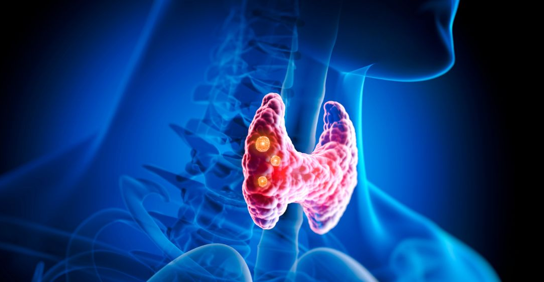 Health: Your Guide to a Healthy Thyroid