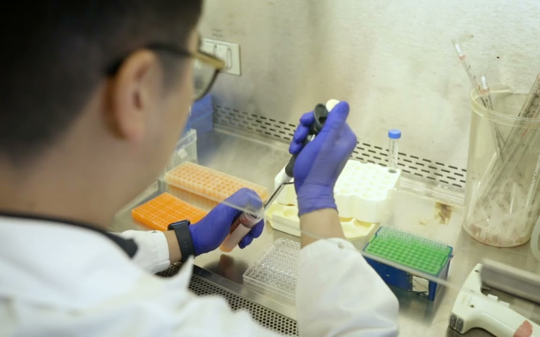 Scientists Identify Potential Root Cause of Lupus, Paving Way for New Treatments