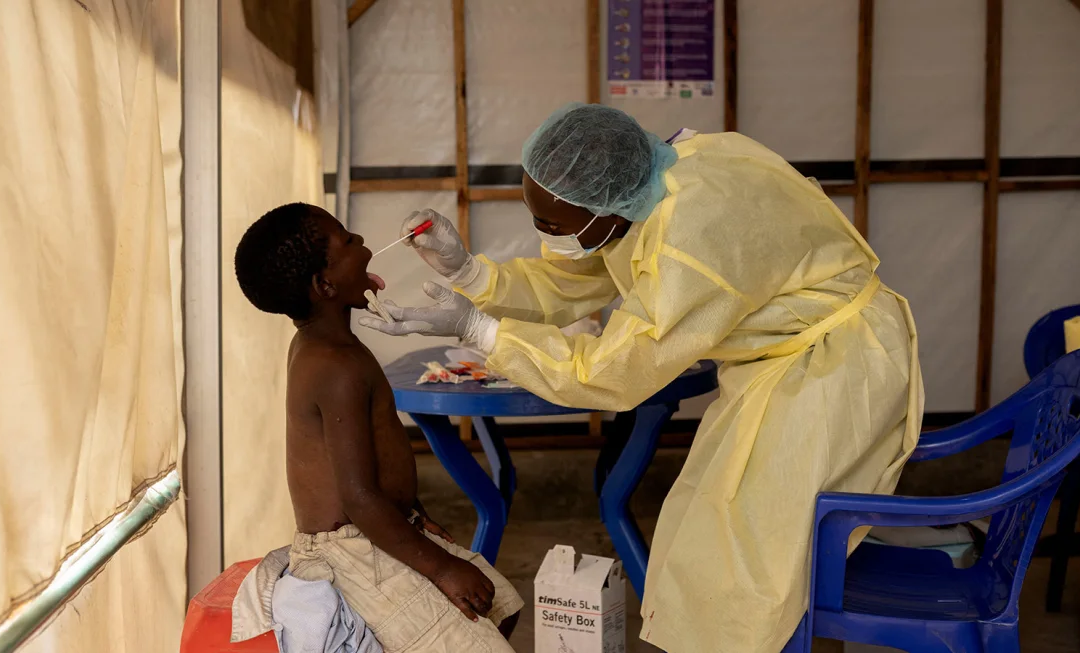 WHO Declares Mpox Outbreak a Global Health Emergency