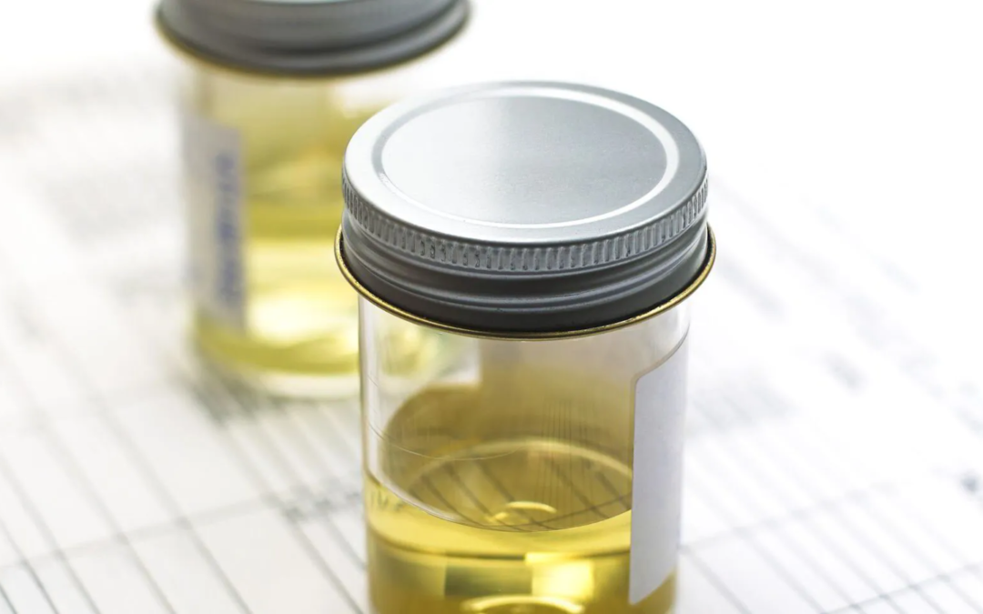 Understanding Urine Colors: What They Mean for Your Health