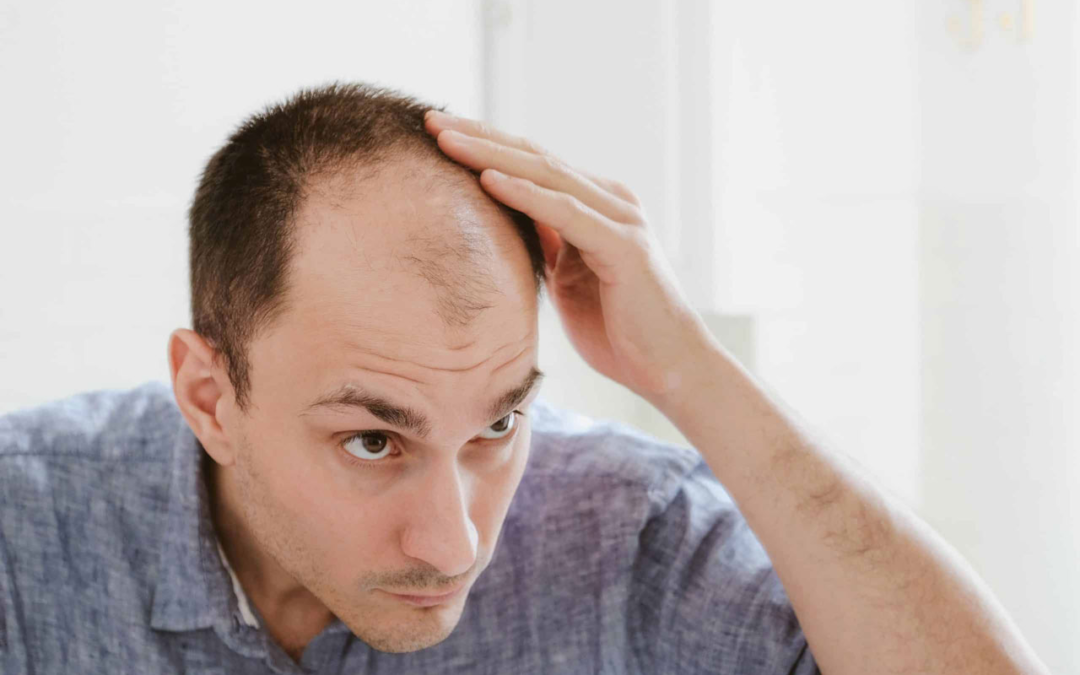 Battling the Bald: Your Ultimate Guide to Winning the Hair War
